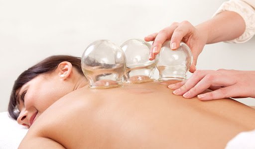 Traditional Fire Cupping