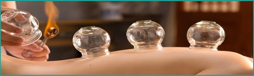 Cupping Therapy Ferntree Gully